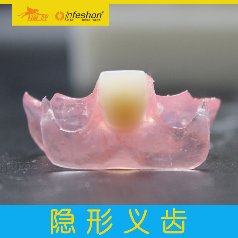 贵金属假牙(贵金属假牙可以做核磁共振)