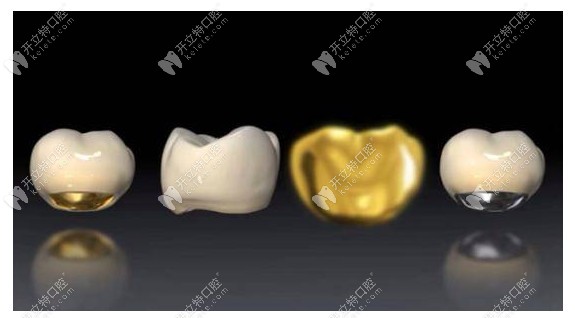 烤瓷牙贵金属(烤瓷牙贵金属多少钱一颗)